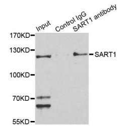 U4/U6.U5 Tri-SnRNP-Associated Protein 1 (SART1) Antibody