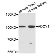 Western blot analysis of extracts of various cell lines, using ADCY1 antibody (abx124162) at 1/1000 dilution.