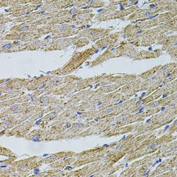 Transient Receptor Potential Cation Channel Subfamily A Member 1 (TRPA1) Antibody