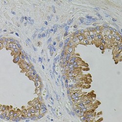 Transient Receptor Potential Cation Channel Subfamily A Member 1 (TRPA1) Antibody