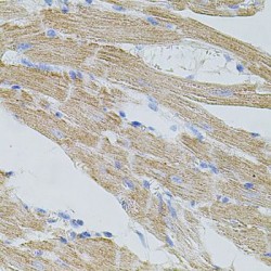 Transient Receptor Potential Cation Channel Subfamily A Member 1 (TRPA1) Antibody