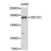 Western blot analysis of extracts of Jurkat cells, using TBC1D1 antibody (abx124172) at 1:3000 dilution.