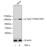 Western blot analysis of extracts of HeLa cells, using Phospho-Tyk2-Y1054/1055 antibody (abx124178).