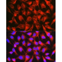 Neural Cell Adhesion Molecule L1 (L1CAM) Antibody