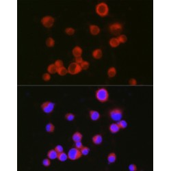 Neural Cell Adhesion Molecule L1 (L1CAM) Antibody