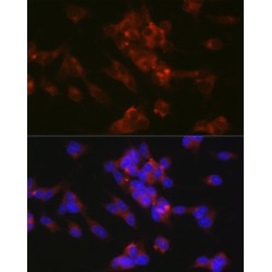 Neural Cell Adhesion Molecule L1 (L1CAM) Antibody