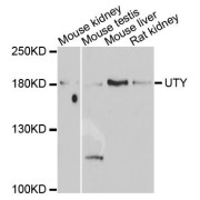 Western blot analysis of extracts of various cell lines, using UTY antibody (abx124206) at 1/1000 dilution.