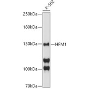 Western blot analysis of extracts of K-562 cells, using HFM1 antibody at 1/1000 dilution.