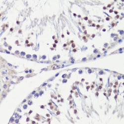 Probable ATP-Dependent DNA Helicase HFM1 (HFM1) Antibody