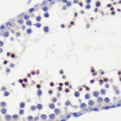 Probable ATP-Dependent DNA Helicase HFM1 (HFM1) Antibody