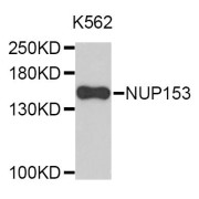 Western blot analysis of extracts of K-562 cells, using NUP153 antibody (abx124227).