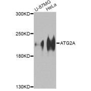 Western blot analysis of extracts of various cell lines, using ATG2A Antibody (abx124255) at 1/1000 dilution.