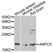 Western blot analysis of extracts of various cell lines, using ARPC5 antibody (abx124274) at 1/1000 dilution.