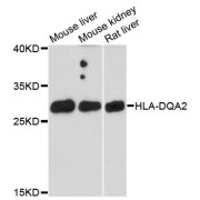 Western blot analysis of extracts of various cell lines, using HLA-DQA2 antibody (abx124334) at 1:3000 dilution.