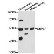 Western blot analysis of extracts of various cell lines, using DNPEP antibody (abx124577) at 1:3000 dilution.