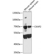 Western blot analysis of extracts of various cell lines, using CKAP2 antibody (1/3000 dilution).
