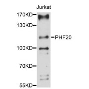 Western blot analysis of extracts of Jurkat cells, using PHF20 antibody (abx124635) at 1:3000 dilution.