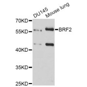 Western blot analysis of extracts of various cell lines, using BRF2 antibody (abx124687) at 1:3000 dilution.