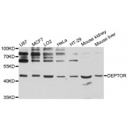 Western blot analysis of extracts of various cell lines, using DEPTOR antibody (abx124761) at 1:3000 dilution.