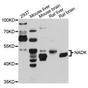 Western blot analysis of extracts of various cell lines, using NADK antibody (abx124774) at 1/1000 dilution.