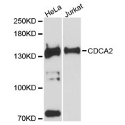 Western blot analysis of extracts of various cell lines, using CDCA2 antibody (abx124896) at 1:3000 dilution.