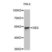 Western blot analysis of extracts of HeLa cells, using DES antibody (abx125113).