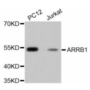 Western blot analysis of extracts of various cell lines, using ARRB1 antibody (abx125293).