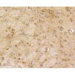 Arrestin Beta 1 (ARRB1) Antibody