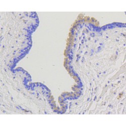 Arrestin Beta 1 (ARRB1) Antibody