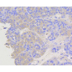 Arrestin Beta 1 (ARRB1) Antibody