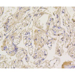 Arrestin Beta 1 (ARRB1) Antibody