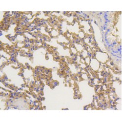 Arrestin Beta 1 (ARRB1) Antibody