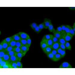 Arrestin Beta 1 (ARRB1) Antibody