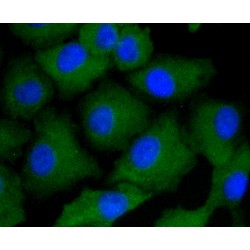 Arrestin Beta 1 (ARRB1) Antibody