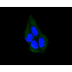 Arrestin Beta 1 (ARRB1) Antibody