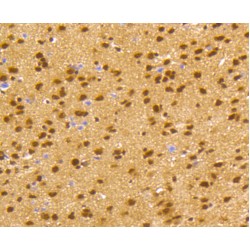 cAMP Responsive Element Binding Protein 1 (CREB1) Antibody