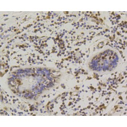 cAMP Responsive Element Binding Protein 1 (CREB1) Antibody