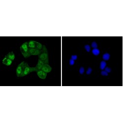 cAMP Responsive Element Binding Protein 1 (CREB1) Antibody