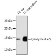 Western blot analysis of extracts of various cell lines, using LYZ antibody.