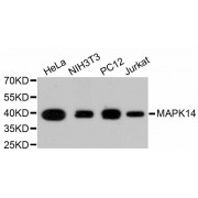 Western blot analysis of extracts of various cell lines, using MAPK14 antibody (abx125362).