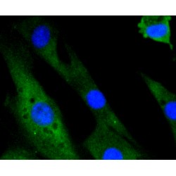 Mitogen-Activated Protein Kinase 14 (MAPK14) Antibody