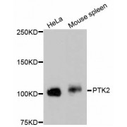 Western blot analysis of extracts of various cell lines, using PTK2 antibody (abx125384).