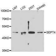 Western blot analysis of extracts of various cell lines, using SEPT4 antibody (abx125463) at 1/1000 dilution.