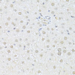 RAC-Alpha Serine/threonine-Protein Kinase (AKT1) Antibody