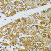 Immunohistochemistry of paraffin-embedded human stomach using ATG5 antibody (abx125545) at dilution of 1/100 (40x lens).