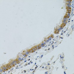 Autophagy Protein 5 (ATG5) Antibody