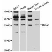 Western blot analysis of extracts of various cell lines, using BCL2 antibody (abx125558) at 1/1000 dilution.