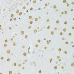 Breast Cancer Type 1 Susceptibility Protein (BRCA1) Antibody