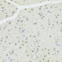 Breast Cancer Type 1 Susceptibility Protein (BRCA1) Antibody