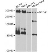 Western blot analysis of extracts of various cell lines, using BRCA1 antibody (abx125577) at 1/1000 dilution.